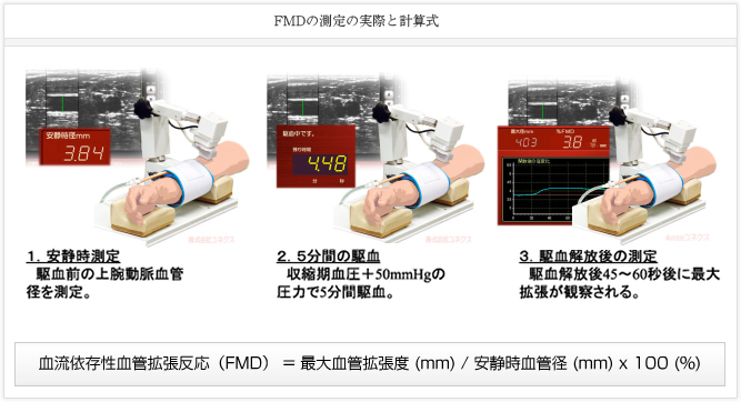 FMDの測定の実際と計算式